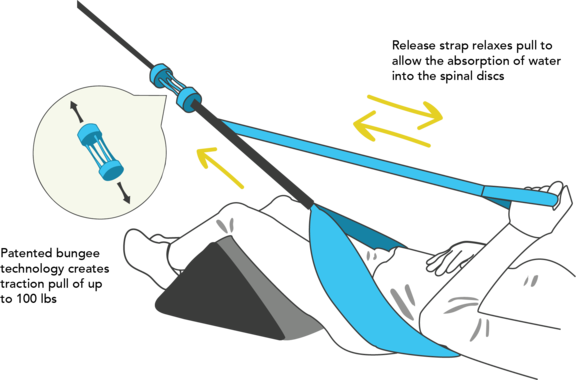 Fisher Traction - Low Back Device